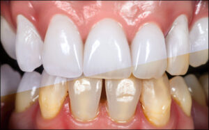 Cosmetic Dentistry