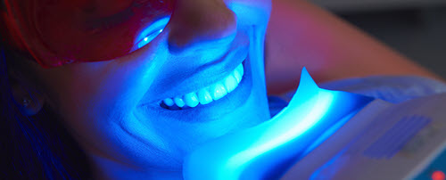 Teeth Whitening