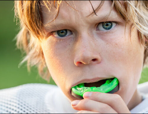Why Mouthguards are Important in Sports