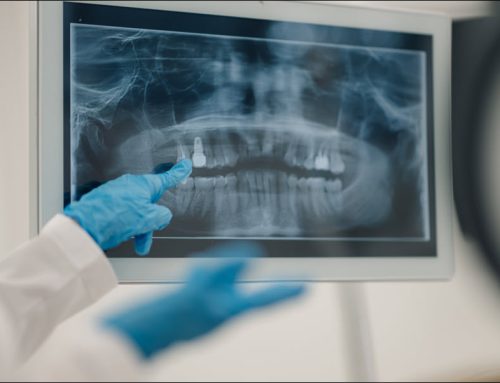 Digital Dental X-Rays: A Clearer Look at Your Oral Health