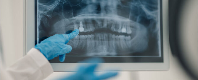 X-rays