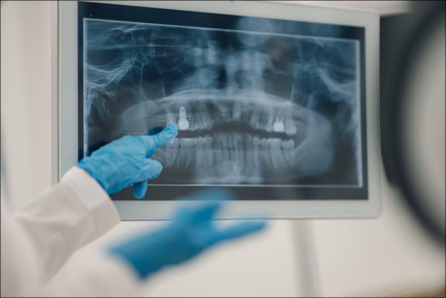 X-rays
